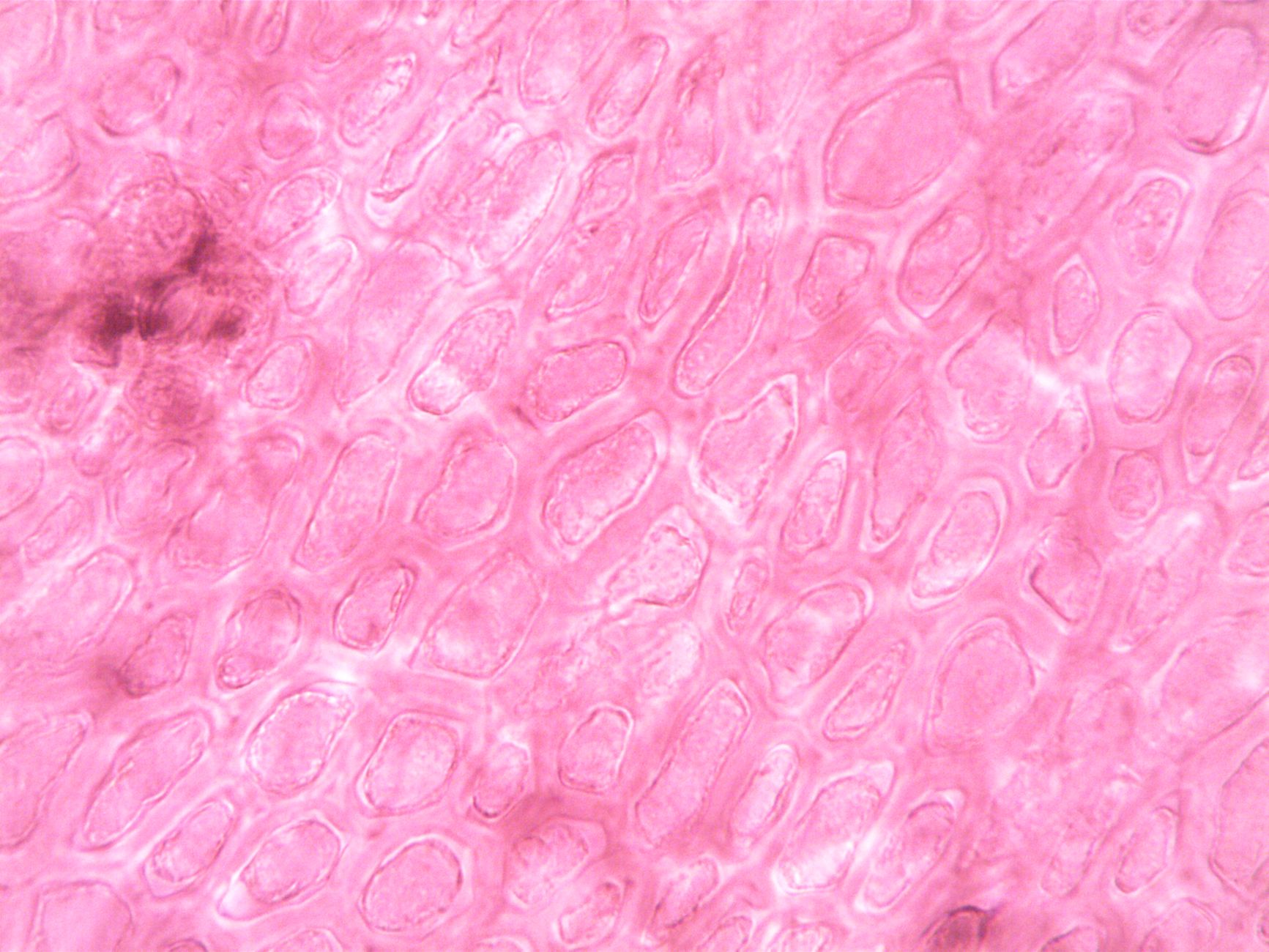 Células de un tejido vegetal observadas al microscopio, con sus estructuras internas