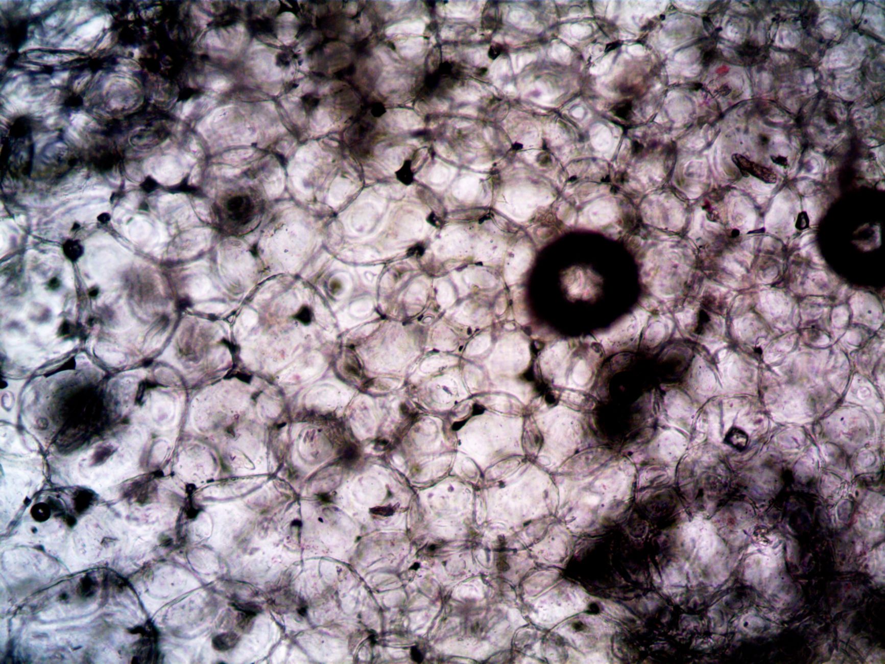 Células vegetales observadas al microscopio, donde se distingue su estructura