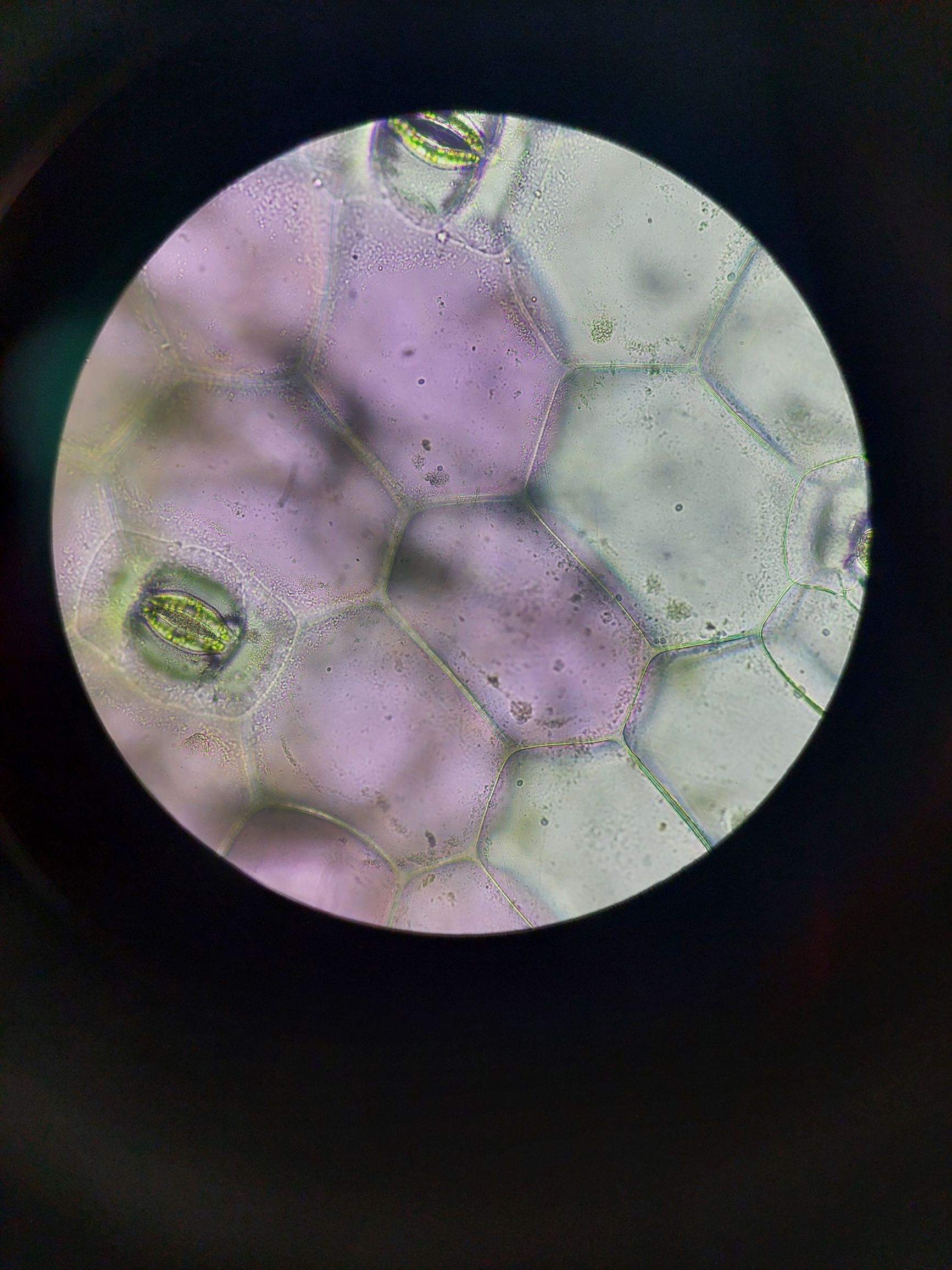 Células vegetales de una hoja observadas al microscopio, con estomas y pigmentos en la vacuola