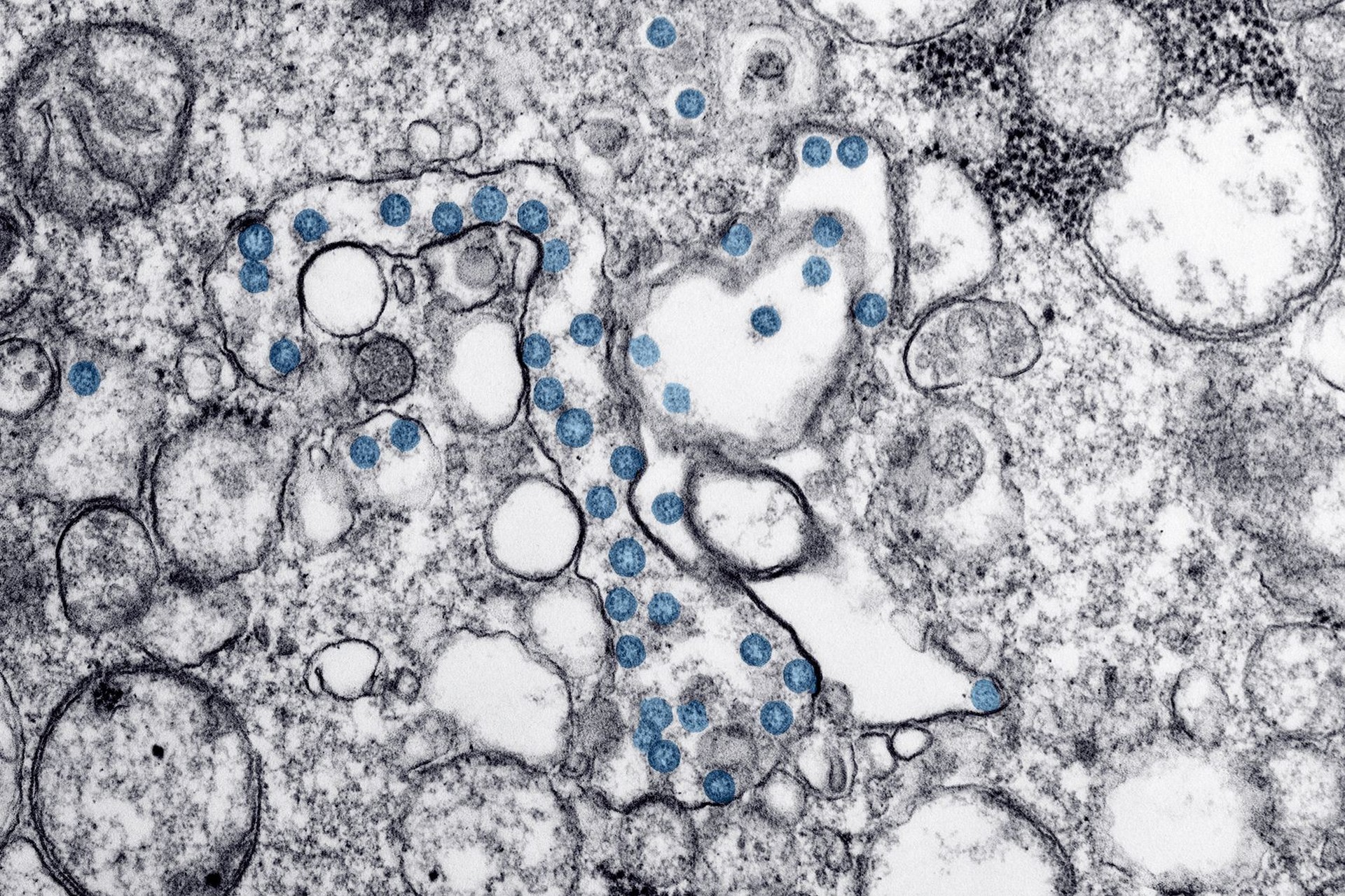 El sistema inmunitario y las defensas del cuerpo